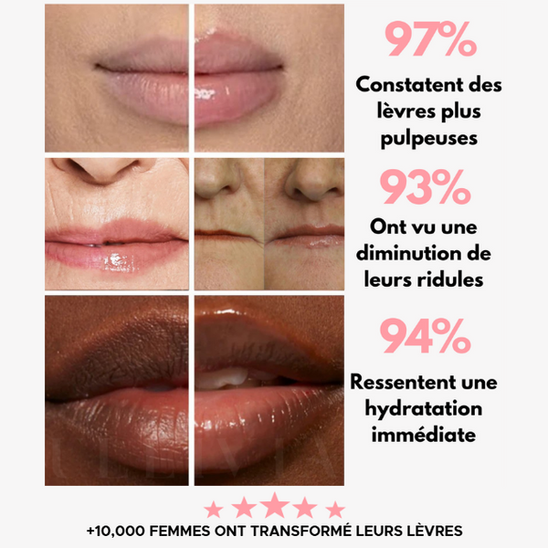 LIPBOOST - Lip Plumper